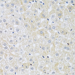 Invitrogen SLC4A5 Polyclonal Antibody 100 &mu;L; Unconjugated:Antibodies,