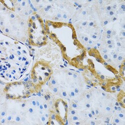 Invitrogen SLC4A5 Polyclonal Antibody 100 &mu;L; Unconjugated:Antibodies,