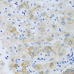 Invitrogen SLC4A5 Polyclonal Antibody 100 &mu;L; Unconjugated:Antibodies,