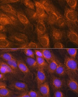 Invitrogen LMAN1 Polyclonal Antibody 100 μL; Unconjugated:Antibodies,