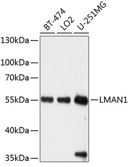 Invitrogen LMAN1 Polyclonal Antibody 100 μL; Unconjugated:Antibodies,