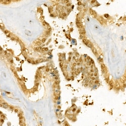 Invitrogen Thymidylate Synthase Polyclonal Antibody 100 &mu;L; Unconjugated:Antibodies,