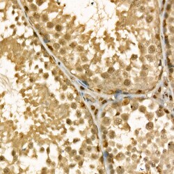 Invitrogen Thymidylate Synthase Polyclonal Antibody 100 &mu;L; Unconjugated:Antibodies,