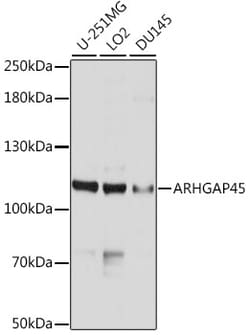 Invitrogen HMHA1 Polyclonal Antibody 100 &mu;L | Buy Online | Invitrogen&trade; | Fisher Scientific