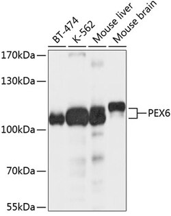 Invitrogen PEX6 Polyclonal Antibody 100 &mu;L; Unconjugated:Antibodies,