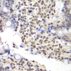 Invitrogen U2AF1 Polyclonal Antibody 100 &mu;L; Unconjugated:Antibodies,