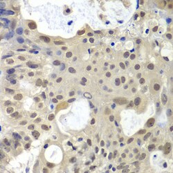 Invitrogen U2AF1 Polyclonal Antibody 100 &mu;L; Unconjugated:Antibodies,