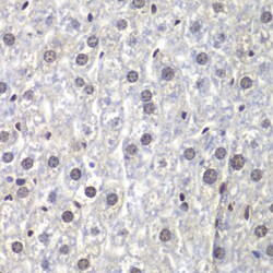Invitrogen U2AF1 Polyclonal Antibody 100 &mu;L; Unconjugated:Antibodies,