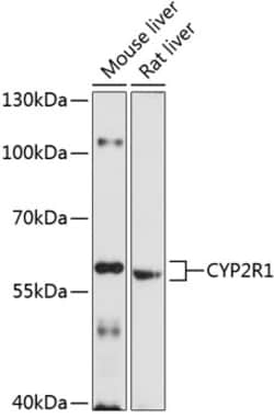 Invitrogen CYP2R1 Polyclonal Antibody 100 &mu;L; Unconjugated:Antibodies,