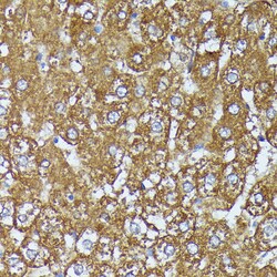 Invitrogen AKR1C2 Polyclonal Antibody 100 &mu;L; Unconjugated:Antibodies,