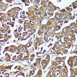 Invitrogen AKR1C2 Polyclonal Antibody 100 &mu;L; Unconjugated:Antibodies,