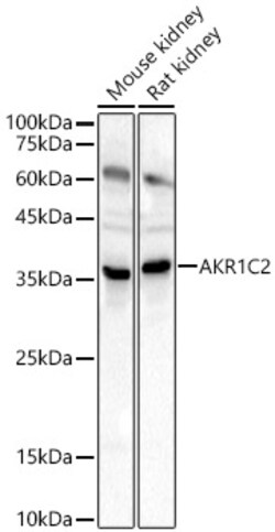 Invitrogen AKR1C2 Polyclonal Antibody 100 &mu;L; Unconjugated:Antibodies,