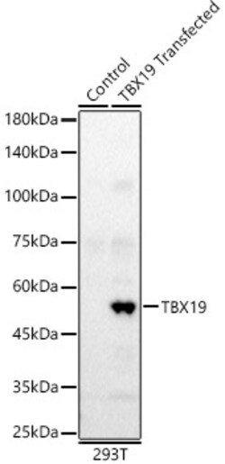 Invitrogen TBX19 Polyclonal Antibody 100 &mu;L; Unconjugated:Antibodies,