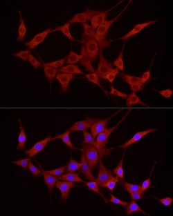 Invitrogen TREM2 Polyclonal Antibody 100 &mu;L; Unconjugated:Antibodies,