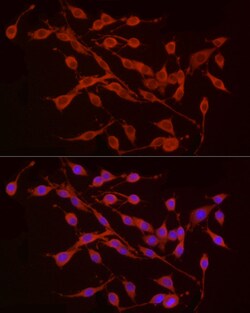 Invitrogen TREM2 Polyclonal Antibody 100 &mu;L; Unconjugated:Antibodies,