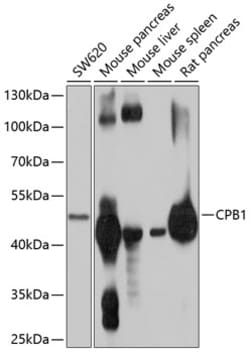 Carboxypeptidase B1 Polyclonal Antibody:Antibodies, Polyclonal