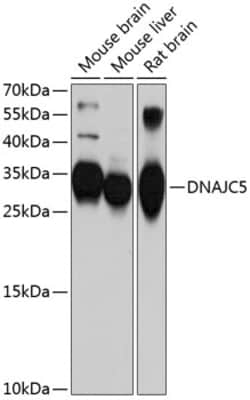 Invitrogen CSP alpha Polyclonal Antibody 100 &mu;L; Unconjugated:Antibodies,