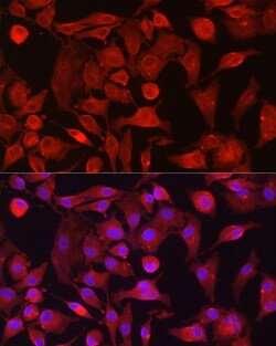 Invitrogen RASGRP1 Polyclonal Antibody 100 &mu;L; Unconjugated:Antibodies,
