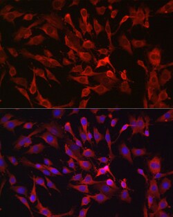 Invitrogen RASGRP1 Polyclonal Antibody 100 &mu;L; Unconjugated:Antibodies,