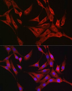 Invitrogen RASGRP1 Polyclonal Antibody 100 &mu;L; Unconjugated:Antibodies,