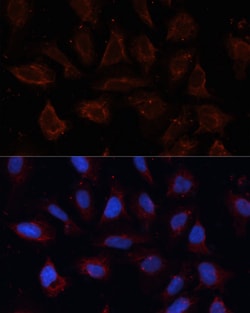 Invitrogen DOG-1 Polyclonal Antibody 100 &mu;L; Unconjugated:Antibodies,