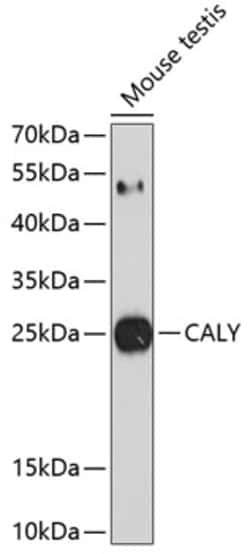 Invitrogen CALY Polyclonal Antibody 100 &mu;L; Unconjugated:Antibodies,