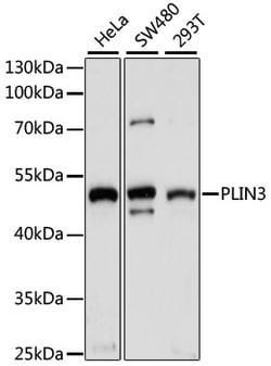 TIP47 Polyclonal Antibody:Antibodies, Polyclonal