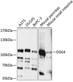 Invitrogen Desmoglein 4 Polyclonal Antibody 100 &mu;L; Unconjugated:Antibodies,