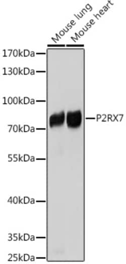 Invitrogen P2X7 Polyclonal Antibody 100 &mu;L; Unconjugated:Antibodies,