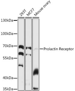 Invitrogen Prolactin Receptor Polyclonal Antibody 100 &mu;L; Unconjugated:Antibodies,