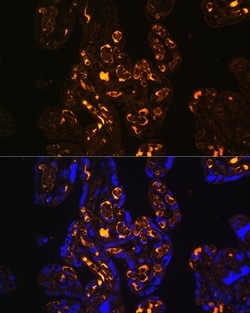 Invitrogen LRP8 Polyclonal Antibody 100 &mu;L; Unconjugated:Antibodies,