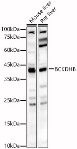 BCKDHB Polyclonal Antibody:Antibodies, Polyclonal
