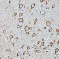 Invitrogen LGR5 Polyclonal Antibody 100 &mu;L | Buy Online | Invitrogen&trade; | Fisher Scientific