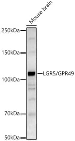 Invitrogen LGR5 Polyclonal Antibody 100 &mu;L | Buy Online | Invitrogen&trade; | Fisher Scientific