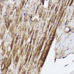 Invitrogen PLOD3 Polyclonal Antibody 100 &mu;L; Unconjugated:Antibodies,