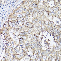Invitrogen SLC16A3 Polyclonal Antibody 100 &mu;L; Unconjugated:Antibodies,