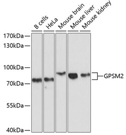 GPSM2 Polyclonal Antibody:Antibodies, Polyclonal