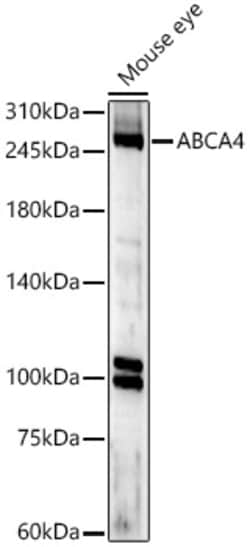 Invitrogen ABCA4 Polyclonal Antibody 100 &mu;L; Unconjugated:Antibodies,