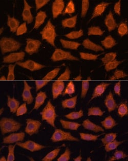 Invitrogen LGMN Polyclonal Antibody 100 &mu;L; Unconjugated:Antibodies,