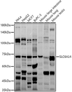 Invitrogen SLC6A14 Polyclonal Antibody 100 &mu;L; Unconjugated:Antibodies,