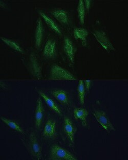 Invitrogen SRPRB Polyclonal Antibody 100 &mu;L; Unconjugated:Antibodies,