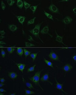 Invitrogen SRPRB Polyclonal Antibody 100 &mu;L; Unconjugated:Antibodies,