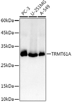 TRMT61A Polyclonal Antibody:Antibodies, Polyclonal