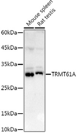 TRMT61A Polyclonal Antibody:Antibodies, Polyclonal