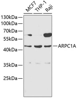 ARPC1A Polyclonal Antibody:Antibodies, Polyclonal