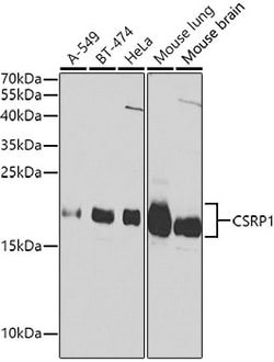 Invitrogen CRP1 Polyclonal Antibody 100 &mu;L; Unconjugated:Antibodies,