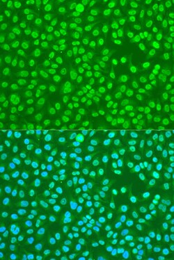 Invitrogen hnRNP DL Polyclonal Antibody 100 &mu;L; Unconjugated:Antibodies,