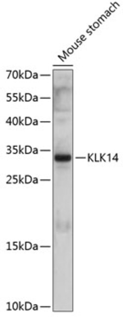 Invitrogen Kallikrein 14 Polyclonal Antibody 100 &mu;L; Unconjugated:Antibodies,