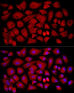 Invitrogen SLC27A2 Polyclonal Antibody 100 &mu;L; Unconjugated:Antibodies,