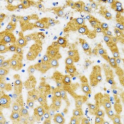 Invitrogen SLC27A2 Polyclonal Antibody 100 &mu;L; Unconjugated:Antibodies,